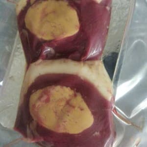 médaillons de magret au foie gras